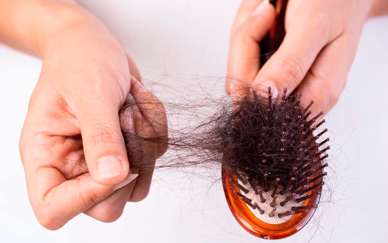 причины сильного выпадения волос у женщин