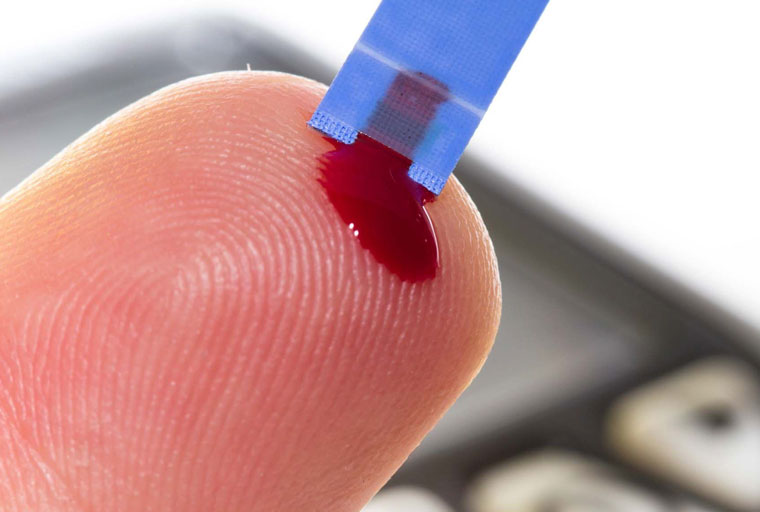 как берут анализ крови из пальца